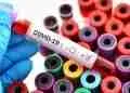 Ethiopia’s scientific pursuit to combat Covid-19 - Ethiopian Magazine | Ethiopian News