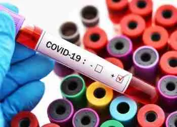 Ethiopia’s scientific pursuit to combat Covid-19 - Ethiopian Magazine | Ethiopian News